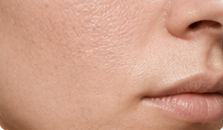 Improves Skin Texture