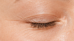 Reduces the Look of Fine Lines