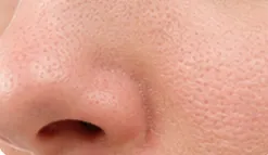 Helps Keep Pores Clear