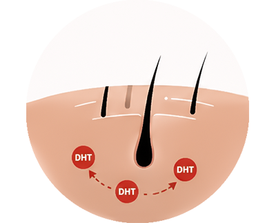 Prevent hair loss