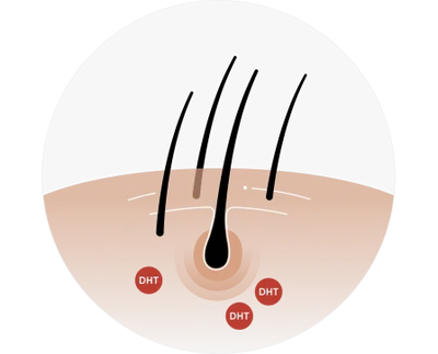 Prevent hair loss
