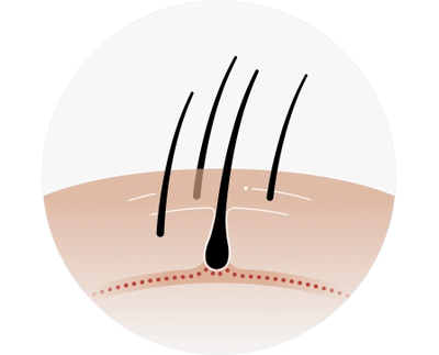 Promote regrowth