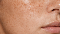 Helps Even Skin Tone