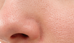 Helps Keep Pores Clear